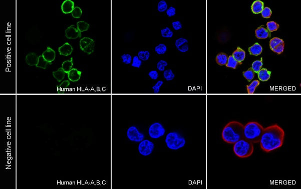Mouse anti-human HLA-ABC antibody (W6/32)