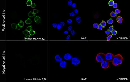 Mouse anti-human HLA-ABC antibody (W6/32)