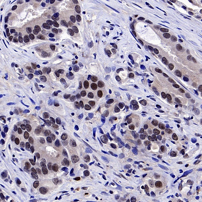 ERCC1 Recombinant Rabbit mAb (SDT-2458-29)
