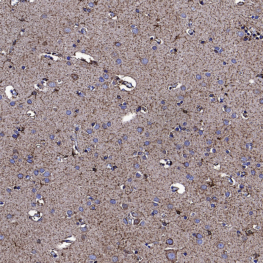 GLUD1 Mouse mAb