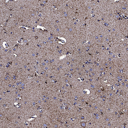 GLUD1 Mouse mAb