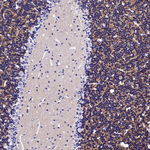 KCND2 Recombinant Rabbit mAb (S-3102-32)