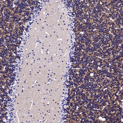 KCND2 Recombinant Rabbit mAb (S-3102-32)