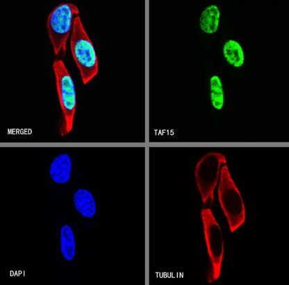 TAF15 Recombinant Rabbit mAb (S-1508-53)