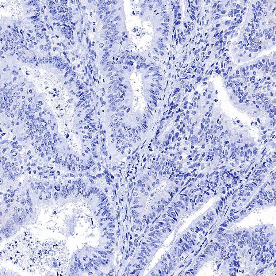 STEAP1+STEAP1B1+STEAP1B2 Recombinant Rabbit mAb (S-3226-137)