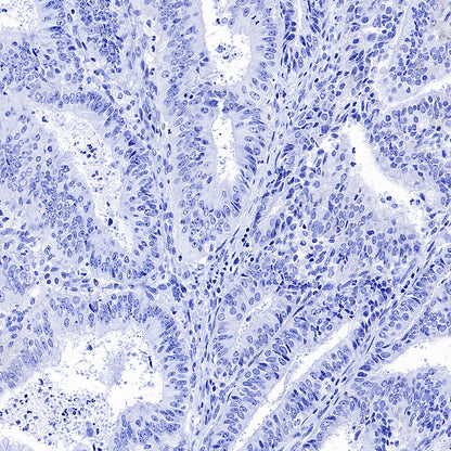 STEAP1+STEAP1B1+STEAP1B2 Recombinant Rabbit mAb (S-3226-137)
