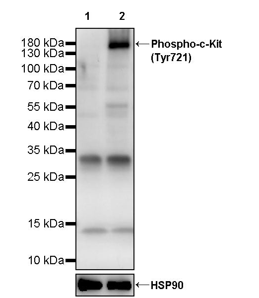 Phospho-c-Kit (Tyr721) Recombinant Rabbit mAb (S-3481-5)