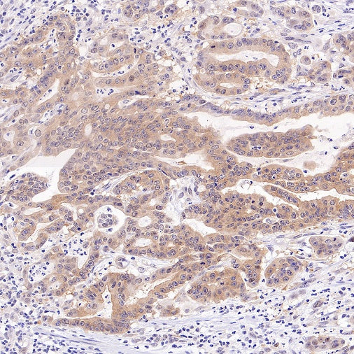 PRMT5 Recombinant Rabbit mAb (S-2336-126)