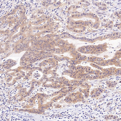 PRMT5 Recombinant Rabbit mAb (S-2336-126)