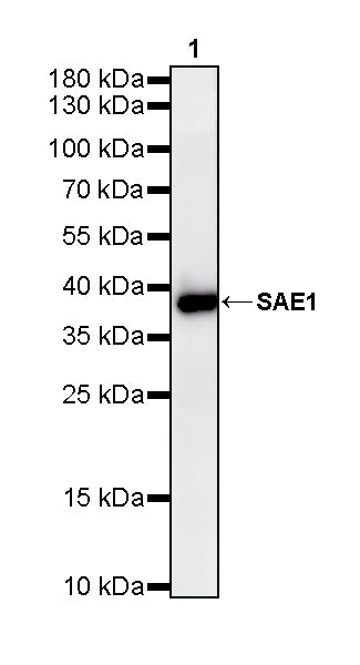 SAE1 Rabbit Polyclonal Antibody