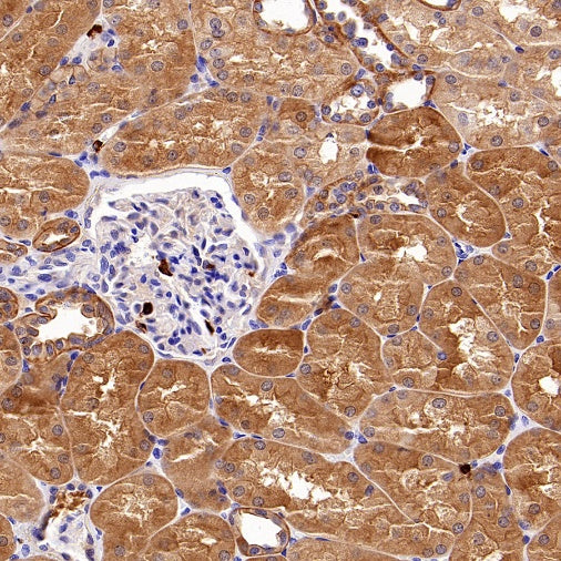 ART1 Recombinant Rabbit mAb (S-2396-1)