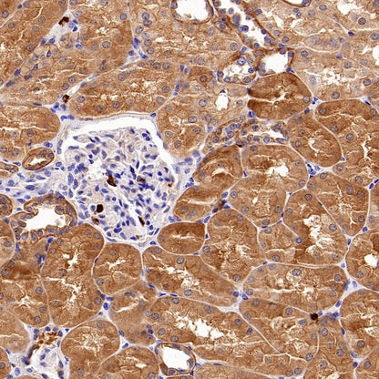 ART1 Recombinant Rabbit mAb (S-2396-1)