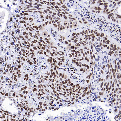 Bmi1 Recombinant Rabbit mAb (S-5143)