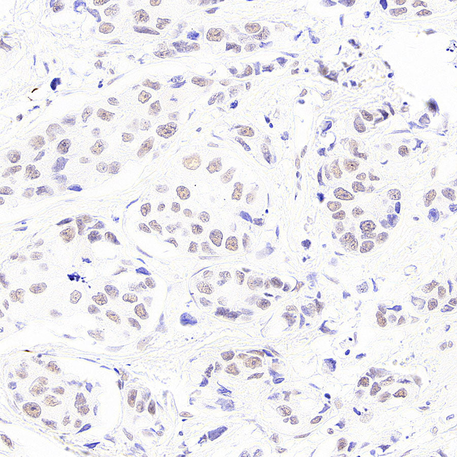 BAP1 Recombinant Rabbit mAb (S-6199)