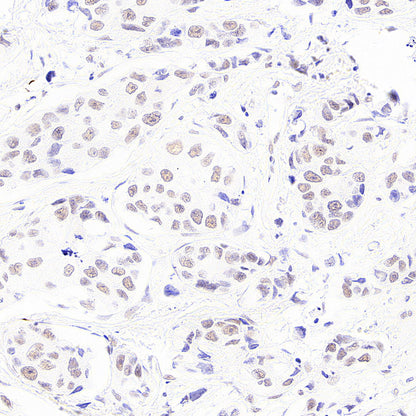 BAP1 Recombinant Rabbit mAb (S-6199)