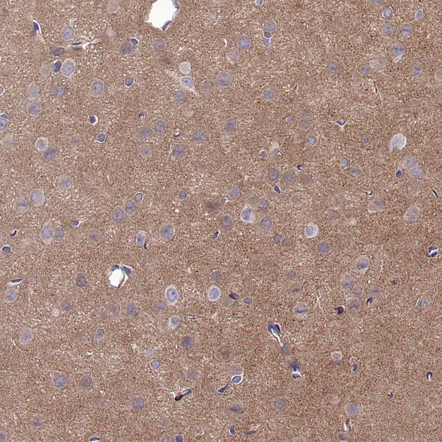 BCAR1 Recombinant Rabbit mAb (S-3542-49)