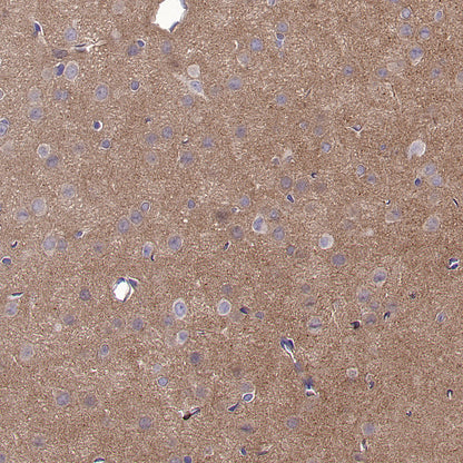 BCAR1 Recombinant Rabbit mAb (S-3542-49)