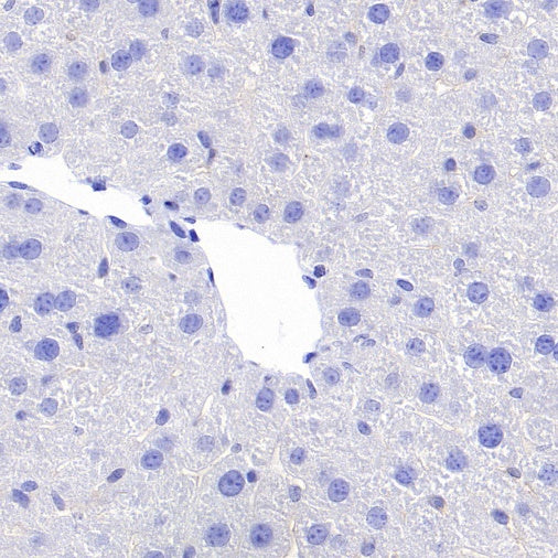 Ctip2 Recombinant Rabbit mAb (S-1375-21)