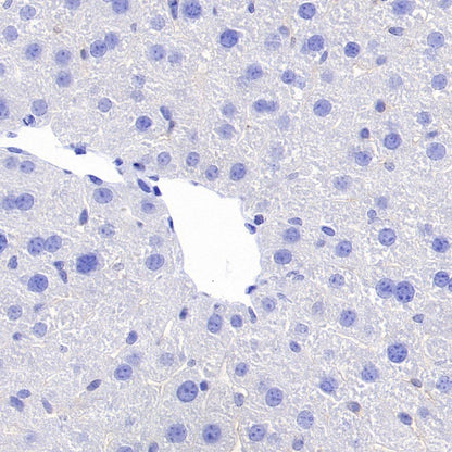 Ctip2 Recombinant Rabbit mAb (S-1375-21)