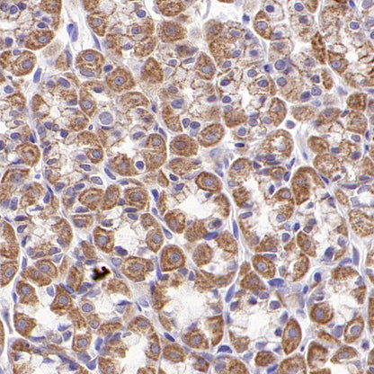 VDAC3 Rabbit Polyclonal Antibody