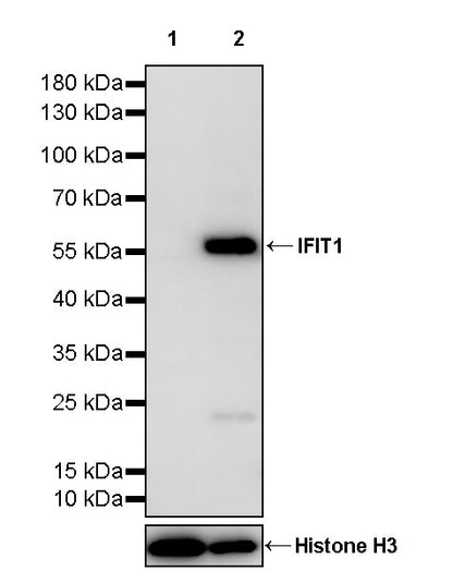 IFIT1 Recombinant Rabbit mAb (S-5120)