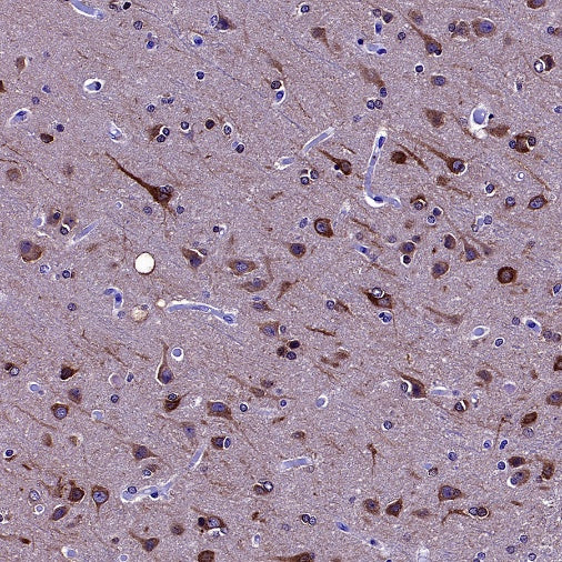 PSAP Recombinant Rabbit mAb (S-2399-11)
