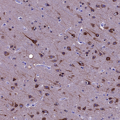 PSAP Recombinant Rabbit mAb (S-2399-11)