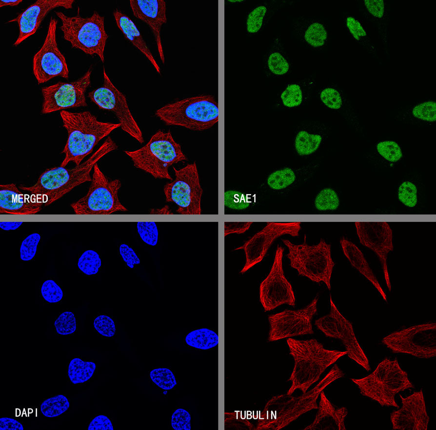 SAE1 Rabbit Polyclonal Antibody