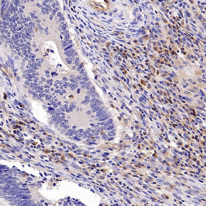 PLCγ2 Recombinant Rabbit mAb (S-2749-14)