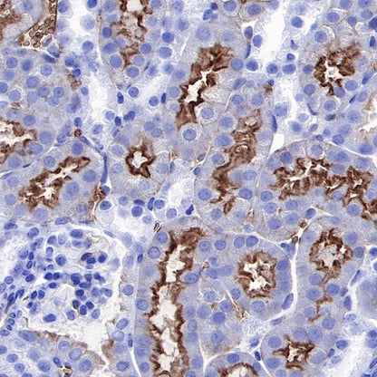 Aquaporin 1/AQP1 Recombinant Rabbit mAb (S-794-79)