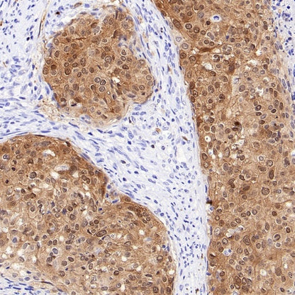 CDKN2A/p16 INK4A Recombinant Mouse mAb (SDT-4675)