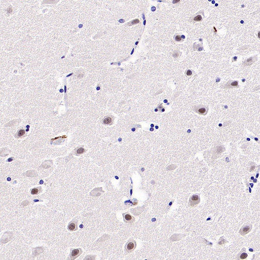 NeuroD2 Recombinant Rabbit mAb (S-3092-64)