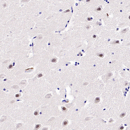 NeuroD2 Recombinant Rabbit mAb (S-3092-64)