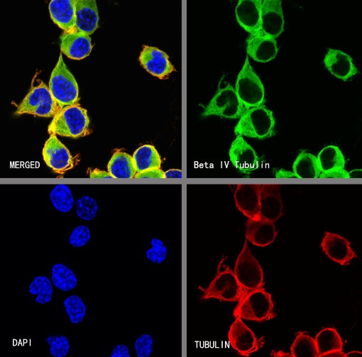 Beta IV Tubulin Recombinant Rabbit mAb (S-1572-30)