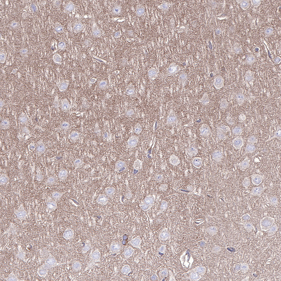 AMPKα Recombinant Rabbit mAb (S-455-38)
