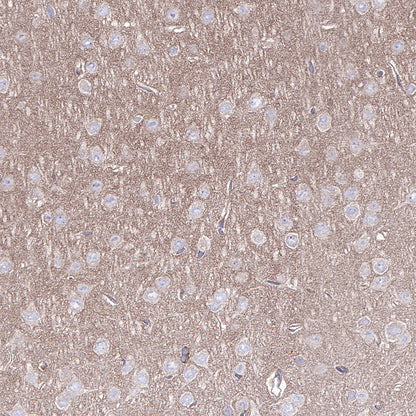 AMPKα Recombinant Rabbit mAb (S-455-38)