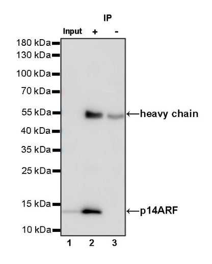 p14ARF Recombinant Rabbit mAb (S-R244)