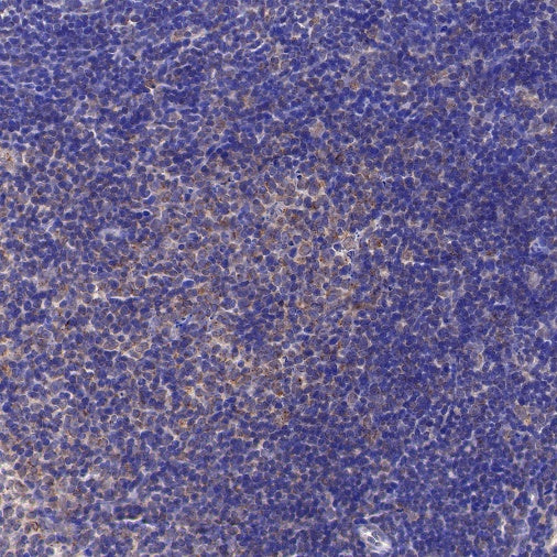 Trim30a Recombinant Rabbit mAb (S-1753-35)