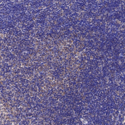 Trim30a Recombinant Rabbit mAb (S-1753-35)