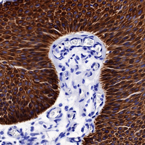 CK-13 Recombinant Rabbit mAb (SDT-641-41)