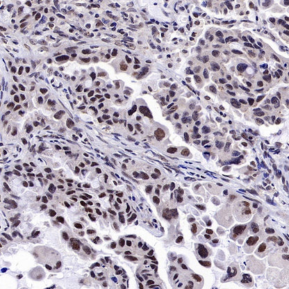 ALKBH5 Recombinant Rabbit mAb (S-2264-39)