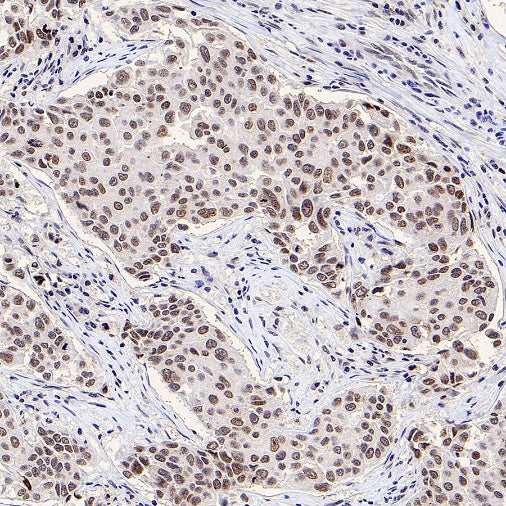 SF2 Recombinant Rabbit mAb (S-1845-27)