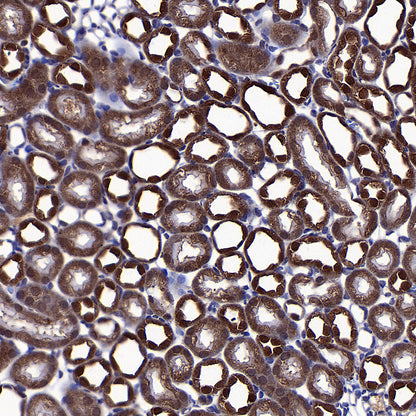 PGK1 Mouse mAb