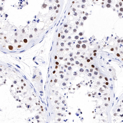 PARP1 Recombinant Rabbit mAb (S-220-179)