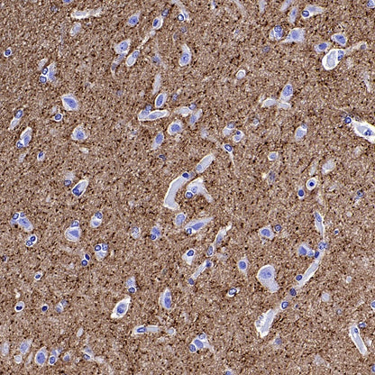 iNOS Recombinant Rabbit mAb (S-2493-61)