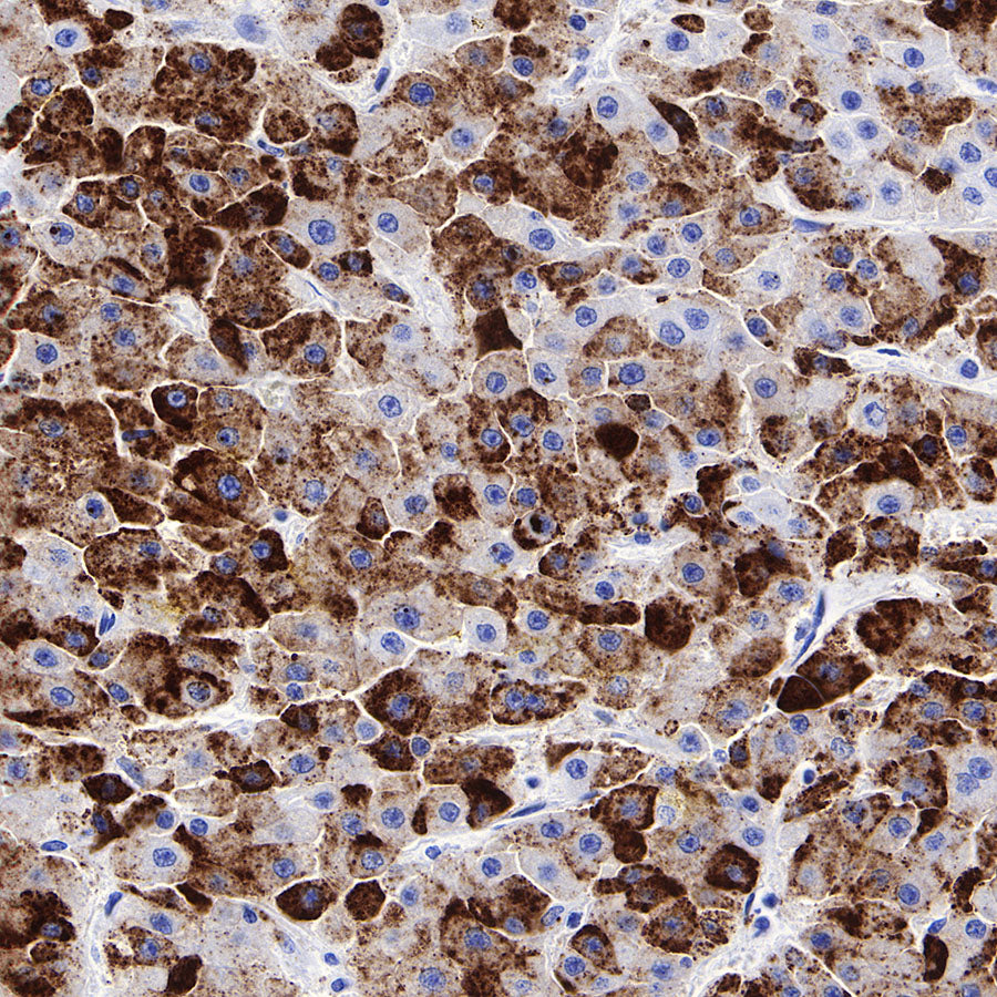 iNOS Recombinant Rabbit mAb (SDT-R131)