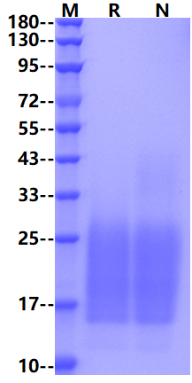 Endothelin B Receptor His Tag Protein, Human