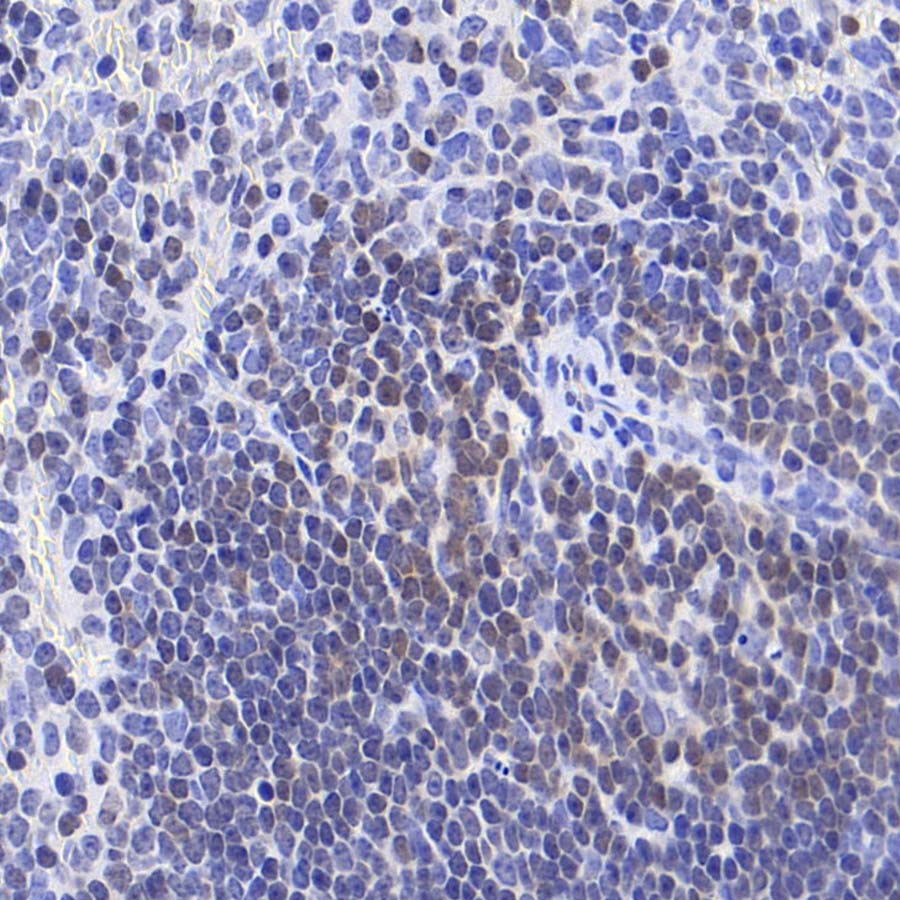 FoxO1 Recombinant Rabbit mAb (S-5118)