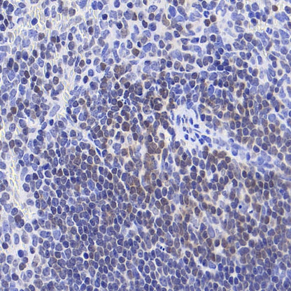 FoxO1 Recombinant Rabbit mAb (S-5118)