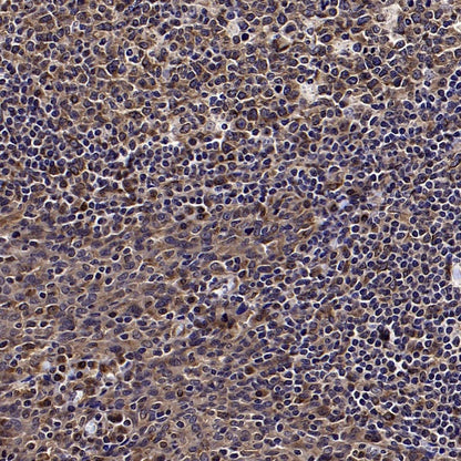 ISL2 Rabbit Polyclonal Antibody
